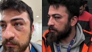 Yer: Şişli Hemşireye eldiven kirli dayağı