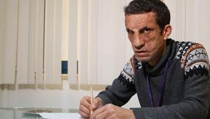 Türkiyenin ilk yüz nakillisi Uğur Acar, üniversiteye hazırlanıyor