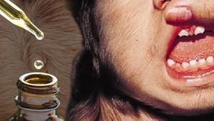 Orta Çağdaki hastalık hortladı Kurt Adama dönüştüler: Sebebi saç spreyi mi