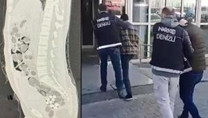 Yer: Denizli Yolcunun midesinden 219 paket uyuşturucu çıktı