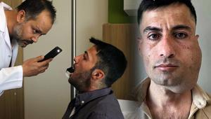 Yüzündeki tümör 12 saatlik ameliyatla alındı