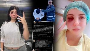 Taciz edildi, sokak ortasında dövüldü: Artık yüzümün sol tarafını hissetmiyorum
