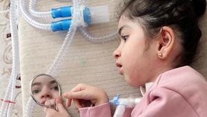 Ailesi gece aç yatırıyor, 19 kilo ağırlığında Esranur’un yardım çığlığı