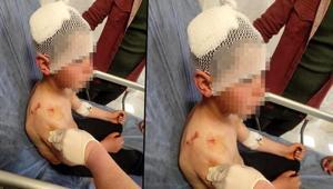 Yer: Isparta Köpeğin saldırdığı 9 yaşındaki çocuk yaralandı