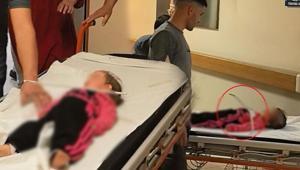 Feci olay 2 yaşındaki kızın oynadığı askı çenesine saplandı