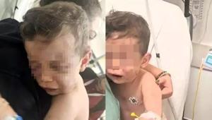 Caniler gözaltında Devlet korumasına alınan 2 yaşındaki Aren bebek ameliyat edilecek