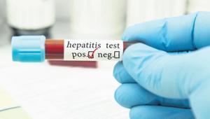 Hepatitte riskli nüfus taranacak