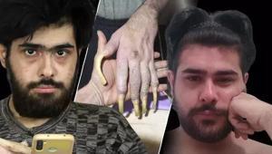 3 yıl sonra evden çıkan Barış için yeni adım Sosyal hayata dönüş yolu açılıyor