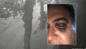 Yer: Bakırköy Kedi beslemek isteyen iş insanına Yolu kapattın dayağı kamerada