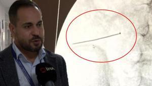 Ağrıyla kıvranan 2 yaşındaki çocuk doktorları şoke etti Ölümüyle sonuçlanabilirdi