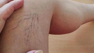 Son yıllarda hızla yaygınlaşıyor Bu hatalar varise davetiye çıkarıyor