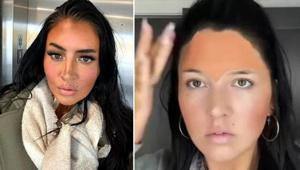 Her gün botoks yaptırdı sandılar Kırışıklık karşıtı tüyo: Saçma değilmiş