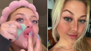 Dolguya gerek kalmadan şişiyor Dolgun dudakların sırrı bu malzemedeymiş