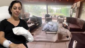 Dekoratif şömine bomba gibi patladı Ölümden döndü: Alev alev yanıyordum