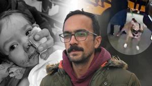 12 kez şikayet edilmiş: İlla çocuğumun suratının parçalanması mı gerekiyordu