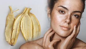 Doğum ve güneş lekelerine birebir Sadece bir muz kabuğu yeterli