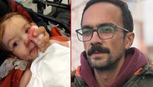 Pitbull dehşetinde yüzünden yaralanan minik Efeden haber geldi: Ne yazık ki izler kalacakmış