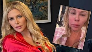 Yüzü eriyordu Gizemli hastalığın sırrı ortaya çıktı