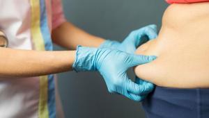 Kilo veremiyorsanız suçlu iradeniz değil Genetik kodunuzda lipödem olabilir