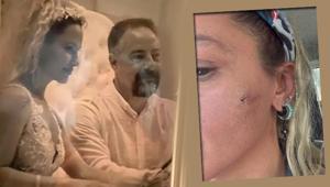 Yıldız Asyalıdan şoke eden iddia Kocam tarafından darp edildim