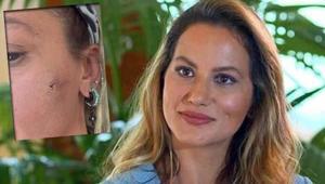 Yıldız Asyalıdan şoke eden paylaşım Kocam tarafından darp edildim