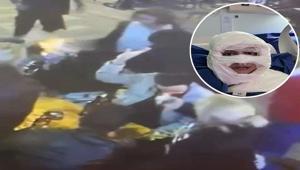 Kadıköyde üzerine yanıcı madde atılmıştı İşte sanığa istenen ceza