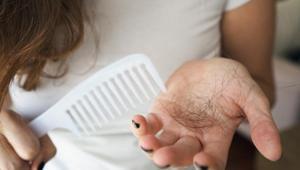 Çok bilinen yöntemler etkili olmayabilir Saç dökülmesinin önüne nasıl geçilir