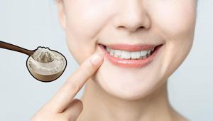 Ev tipi karışımlar diş minesini aşındırıyor Karbonatın beyazlatma etkisi var mı