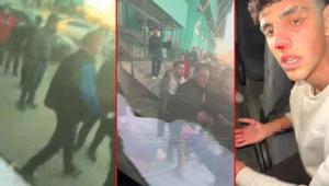 Hatay’da amatör lig maçında kavga 1 futbolcu yaralandı