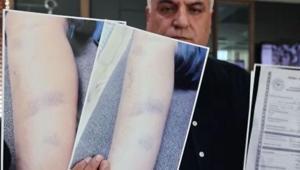 Özel okulda darp iddiası 8 yaşındaki çocuğun ailesi ve okul yönetimi karşı karşıya