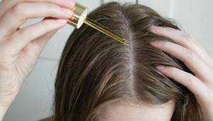 Saç derisini canlandıran serum Sürdükçe kepeği hedef alıyor, masrafsız çözüm