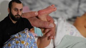 Topuk kanı krizi Aile izin vermedi, bebek için kayyum atanabilir: Evladımız belediye veya şirket değil