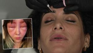 Kaşlarını bu teknikle boyattı, yüzü davul gibi şişti Kendimi tanıyamadım