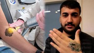 Dövme sildirecekti kabusu oldu: Deri ve doku nakli yapılacak Herkes ve her dövme uygun değil