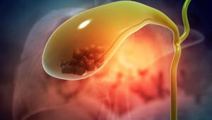 Uzmanı uyardı: İdrar rengi, o hastalığın habercisi olabilir