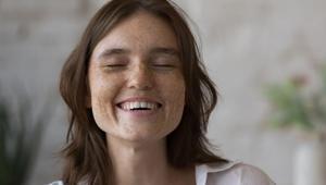 Cildi ışıl ışıl yapan doğal tarif Kararma sorununu kökten bitiriyor