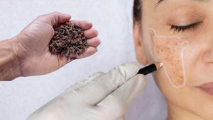 2 tane karanfilden gelen mucize Ton farkı kalmayacak, doğal aydınlatıcı