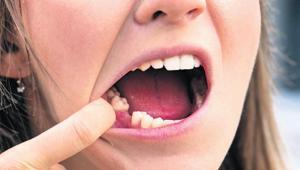 Yaşam süresi dişlerde gizli