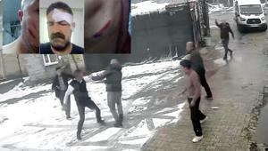 Evinin önüne tuvaletini yapanı uyardı, dayak yedi: Burası dağ başı mı