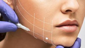 Derin plan yüz germe tekniği kalıcılığıyla fark yaratıyor