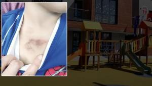 İBB kreşinde darp ve istismar iddiası İstanbul Valiliği soruşturma başlattı