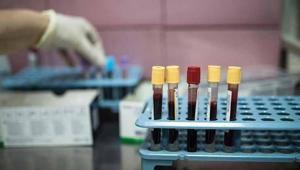 Vücutta kansere doğal kalkan 25 yıllık takip sonuç verdi: İlaca gerek kalmayacak mı