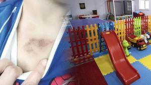 İBBye ait kreşteki darp ve istismar iddialarına yönelik soruşturmada 1 şüpheli tutuklandı