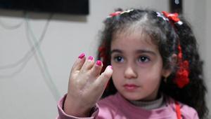 4 yaşındaki Elifin dramı Tedavisi yarım kaldı: Ben de sizin gibi olmak istiyorum