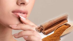İğne yok, kimyasal yok Dudakları doğal yollarla dolgunlaştıran baharat