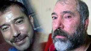 Dolmuş durağında çay bardaklı dehşet Gözünü kaybetti: Beni öldür, böyle bırakma