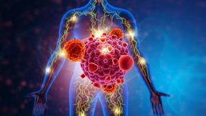 Vücuttaki gizli kanser hücrelerine dikkat Görüntüleme ve testler her zaman yeterli mi