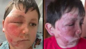 Sosyal medya akımı kör ediyordu, 9 yaşındaki çocuk dehşeti yaşadı Anneden şaşırtan ifade