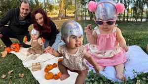 Doğumda öğrendikleri teşhis hayatlarını değiştirdi ‘Doktorun ağzından duymak dünyamı yıktı’