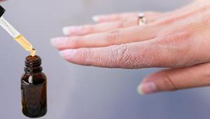 Eldeki çatlakları bir gecede pamuk gibi yapıyor Cilt üzerinde bariyer etkisi